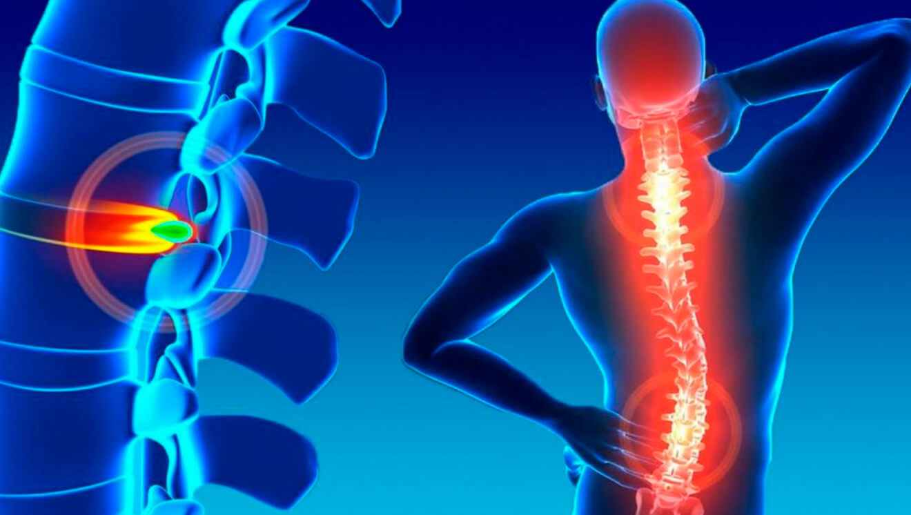 Nonoperative Pain Management: Proven Alternatives to Spine Surgery for Lasting Relief