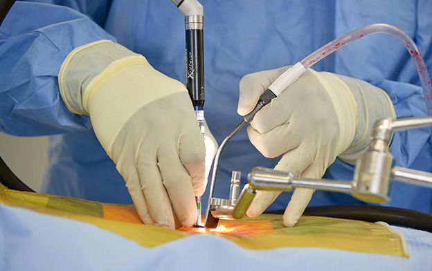 Why Minimally Invasive Surgery Is the Gold Standard in Spine Care